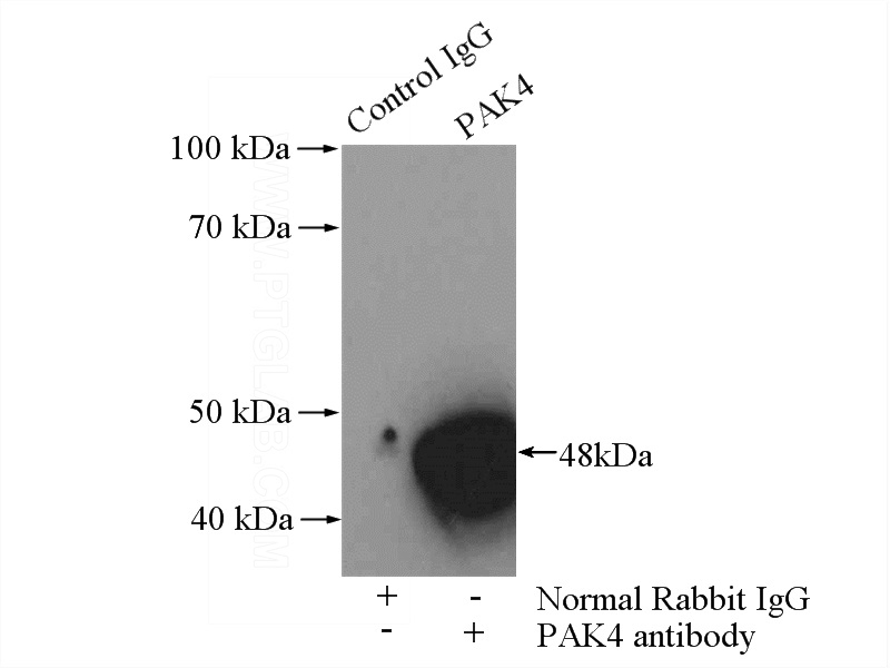 IP Result of anti-PAK4 (IP:Catalog No:113500, 4ug; Detection:Catalog No:113500 1:800) with mouse liver tissue lysate 4000ug.