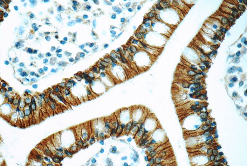 Immunohistochemistry of paraffin-embedded human small intestine tissue slide using Catalog No:113212(NPFFR2 Antibody) at dilution of 1:50 (under 40x lens)