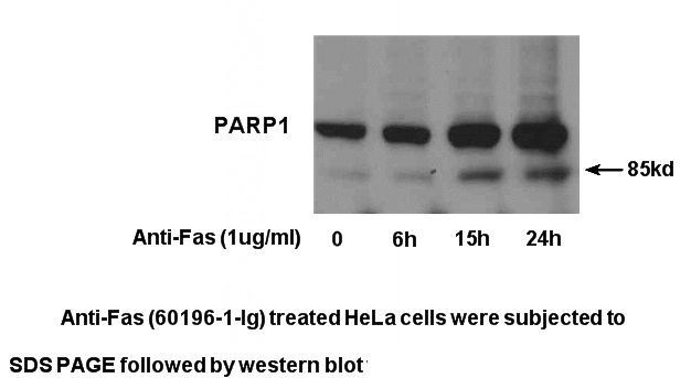 Anti-Fas treated HeLa cells were subjected to SDS PAGE followed by western blot with Catalog No:113588 (PARP1 Antibody) at dilution of 1:1000.