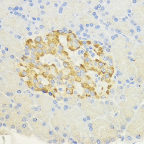 Immunohistochemistry - SURF4 Polyclonal Antibody 