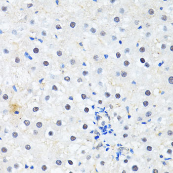 Immunohistochemistry - PRKAG2 Polyclonal Antibody 