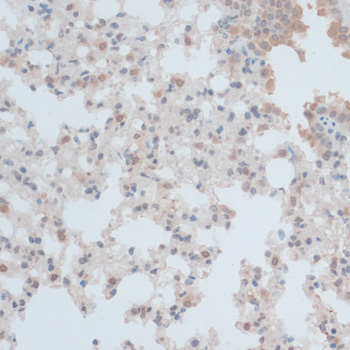 Immunohistochemistry - ZNF446 Polyclonal Antibody 