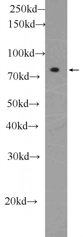 mouse brain tissue were subjected to SDS PAGE followed by western blot with Catalog No:116694(UTP14A Antibody) at dilution of 1:1000