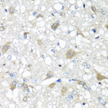 Immunohistochemistry - CCL11 Polyclonal Antibody 