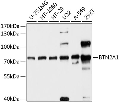 Western blot - BTN2A1 Polyclonal Antibody 
