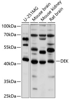 Western blot - DEK Polyclonal Antibody 