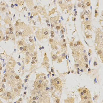 Immunohistochemistry - PSMB5 Polyclonal Antibody 