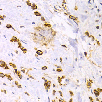 Immunohistochemistry - KRT15 Polyclonal Antibody 