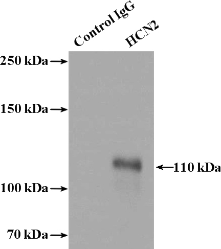 IP Result of anti-HCN2 (IP:Catalog No:111285, 4ug; Detection:Catalog No:111285 1:800) with mouse brain tissue lysate 4000ug.