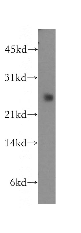 human stomach tissue were subjected to SDS PAGE followed by western blot with Catalog No:109608(CSRP1 antibody) at dilution of 1:500