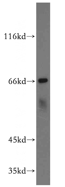 SKOV-3 cells were subjected to SDS PAGE followed by western blot with Catalog No:109660(CCNA1 antibody) at dilution of 1:500