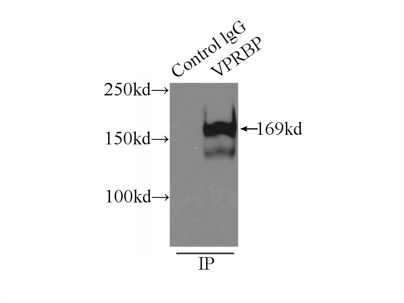 IP Result of anti-VPRBP (IP:Catalog No:116768, 3ug; Detection:Catalog No:116768 1:1000) with HeLa cells lysate 3800ug.