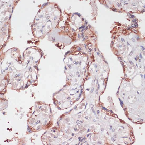 Immunohistochemistry - TPD52 Polyclonal Antibody 