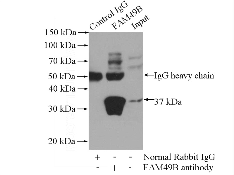 IP Result of anti-FAM49B (IP:Catalog No:110592, 4ug; Detection:Catalog No:110592 1:500) with mouse brain tissue lysate 4000ug.