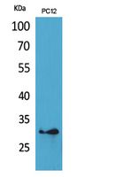 Fig1:; Western Blot analysis of PC12 cells using HLA-DQB1/2 Polyclonal Antibody.. Secondary antibody（catalog#: HA1001) was diluted at 1:20000