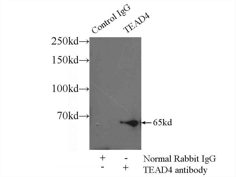 IP Result of anti-TEAD4 (IP:Catalog No:115934, 3ug; Detection:Catalog No:115934 1:300) with MCF-7 cells lysate 2000ug.