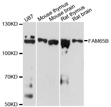 Western blot - FAM65B Polyclonal Antibody 
