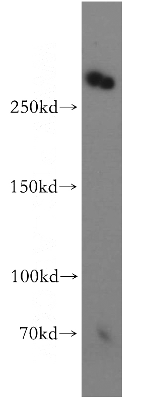 human brain tissue were subjected to SDS PAGE followed by western blot with Catalog No:113329(ODZ1 antibody) at dilution of 1:1500