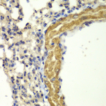 Immunohistochemistry - PRKG1 Polyclonal Antibody 