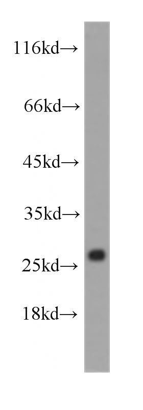 human heart tissue were subjected to SDS PAGE followed by western blot with Catalog No:107228(CYGB antibody) at dilution of 1:1000