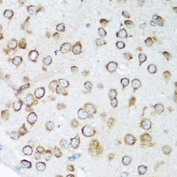 Immunohistochemistry - NOTCH2 Polyclonal Antibody 