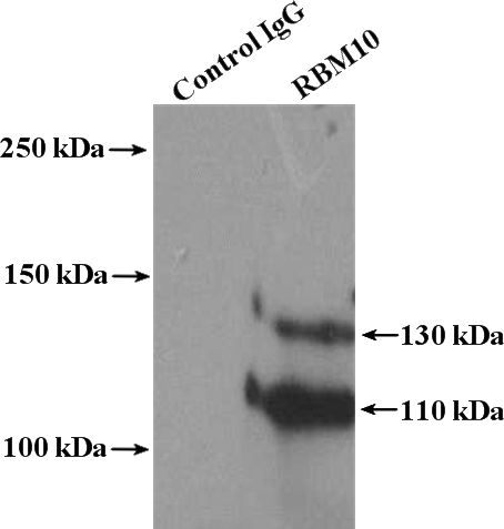 IP Result of anti-RBM10 (IP:Catalog No:114595, 4ug; Detection:Catalog No:114595 1:800) with mouse brain tissue lysate 4000ug.