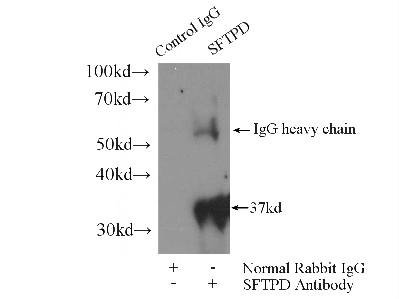 IP Result of anti-SFTPD (IP:Catalog No:115748, 3ug; Detection:Catalog No:115748 1:300) with mouse lung tissue lysate 2800ug.