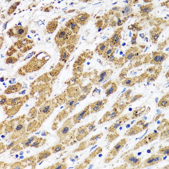 Immunohistochemistry - HAPLN1 Polyclonal Antibody 