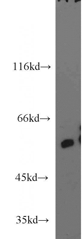 mouse testis tissue were subjected to SDS PAGE followed by western blot with Catalog No:108174(ARSA antibody) at dilution of 1:1000