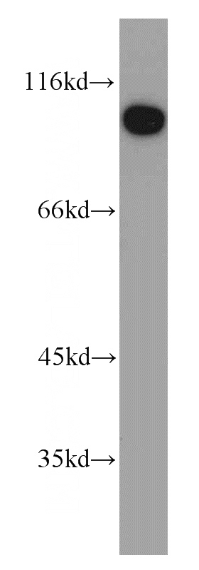 Jurkat cells were subjected to SDS PAGE followed by western blot with Catalog No:109621(CTAGE1 antibody) at dilution of 1:800