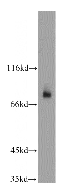 L02 cells were subjected to SDS PAGE followed by western blot with Catalog No:111451(HPS1 antibody) at dilution of 1:800