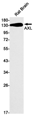 Western blot detection of AXLRabbit mAb in Hela cell lysates using AXLRabbit mAb(1:1000 diluted).Predicted band size:98kDa.Observed band size:138kDa.