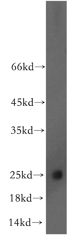 mouse heart tissue were subjected to SDS PAGE followed by western blot with Catalog No:109313(CIDEA antibody) at dilution of 1:100
