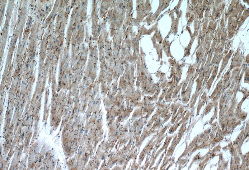 Immunohistochemistry of paraffin-embedded human heart tissue slide using Catalog No:107317(MB Antibody) at dilution of 1:50 (under 10x lens)
