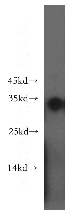 PC-3 cells were subjected to SDS PAGE followed by western blot with Catalog No:112959(NAT1 antibody) at dilution of 1:500