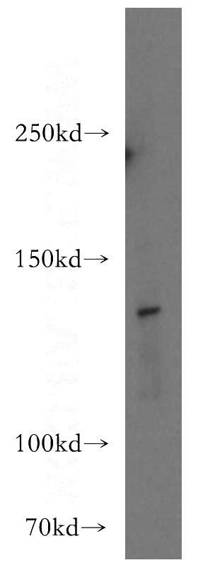 HEK-293 cells were subjected to SDS PAGE followed by western blot with Catalog No:110938(GEMIN4 antibody) at dilution of 1:100