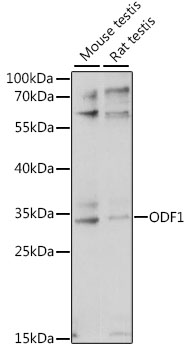 Western blot - ODF1 Polyclonal Antibody 