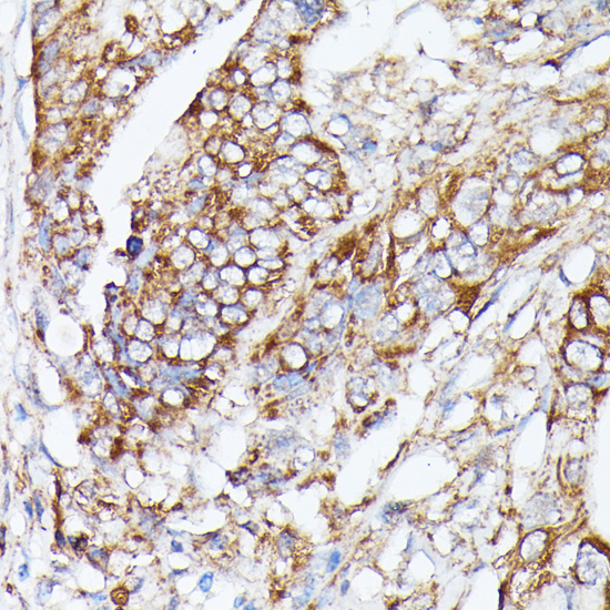 Immunohistochemistry - NUBP1 Polyclonal Antibody 