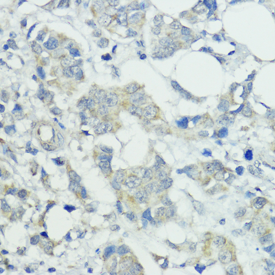 Immunohistochemistry - SOCS5 Polyclonal Antibody 