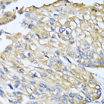 Immunohistochemistry - CCL8 Polyclonal Antibody 