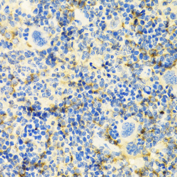 Immunohistochemistry - ICOS Polyclonal Antibody 
