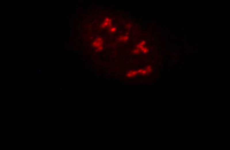 Immunofluorescent analysis of Hela cells, using ALG13 antibody Catalog No:107980 at 1:25 dilution and Rhodamine-labeled goat anti-rabbit IgG (red).