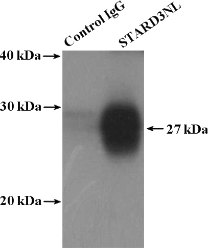IP Result of anti-STARD3NL (IP:Catalog No:115679, 4ug; Detection:Catalog No:115679 1:500) with HEK-293 cells lysate 3200ug.