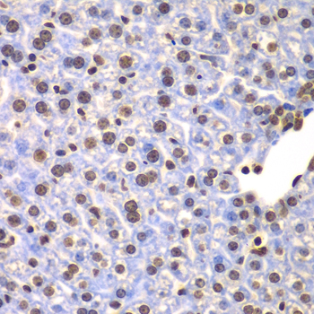 Immunohistochemistry - ULK4 Polyclonal Antibody 