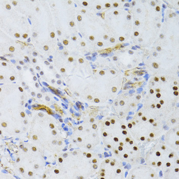 Immunohistochemistry - SNRNP70 Polyclonal Antibody 