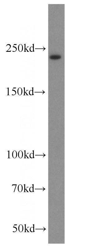 human placenta tissue were subjected to SDS PAGE followed by western blot with Catalog No:111022(GLI3-Specific antibody) at dilution of 1:400