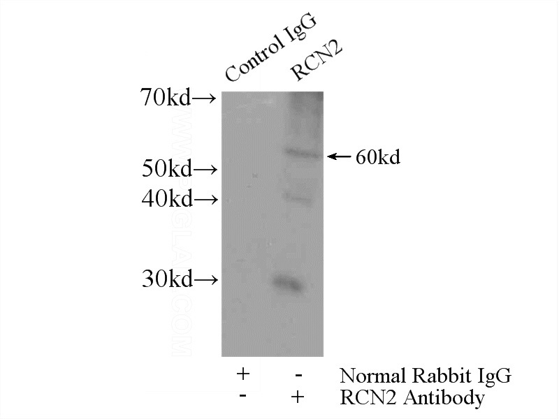IP Result of anti-RCN2 (IP:Catalog No:114579, 4ug; Detection:Catalog No:114579 1:400) with mouse lung tissue lysate 2800ug.