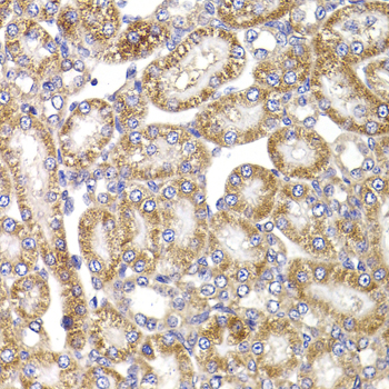 Immunohistochemistry - ANAPC5 Polyclonal Antibody 