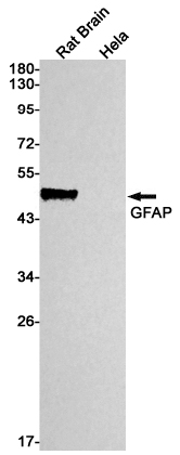 Western blot detection of GFAP in Rat Brain,Hela cell lysates using GFAP Rabbit mAb(1:1000 diluted).Predicted band size:50kDa.Observed band size:50kDa.