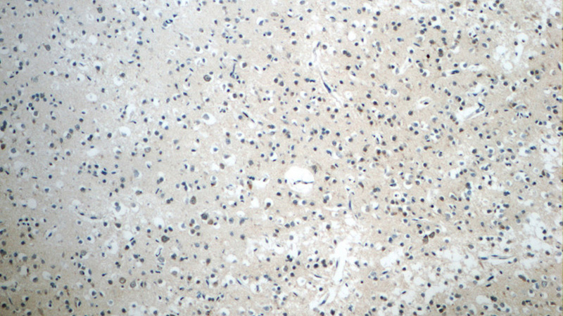 Immunohistochemistry of paraffin-embedded human brain tissue slide using Catalog No:115767(SYNJ2 Antibody) at dilution of 1:50 (under 10x lens)